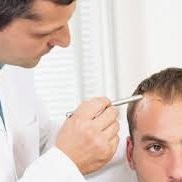 Hair Transplant Birmingham UK